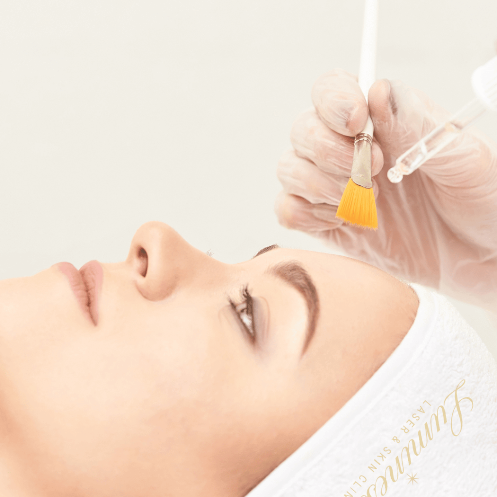 renew-your-skins-radiance-chemical-peels-luminesse-laser