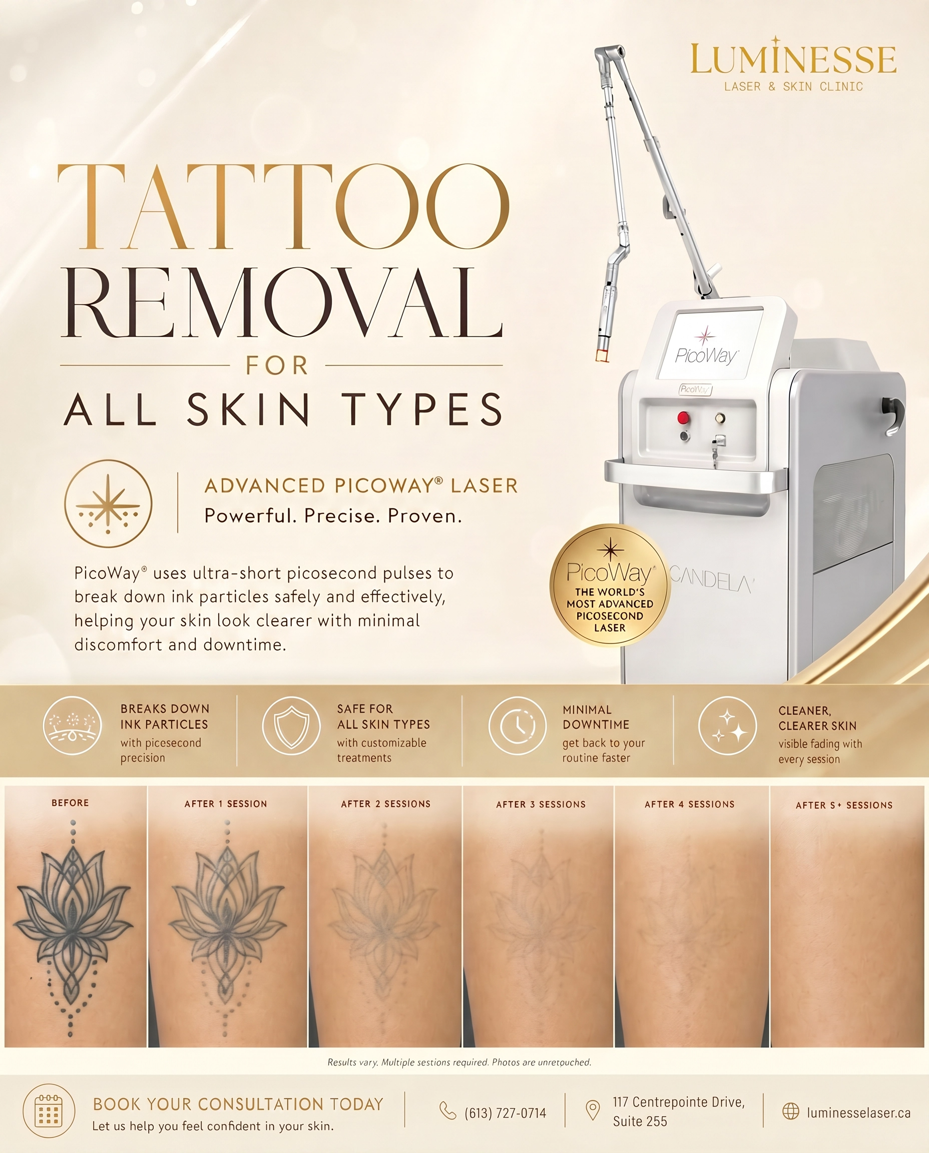 Tattoo removal advertisement featuring a PicoWay laser device and large text 'TATTOO REMOVAL FOR ALL SKIN TYPES' from Luminesse Laser & Skin Clinic