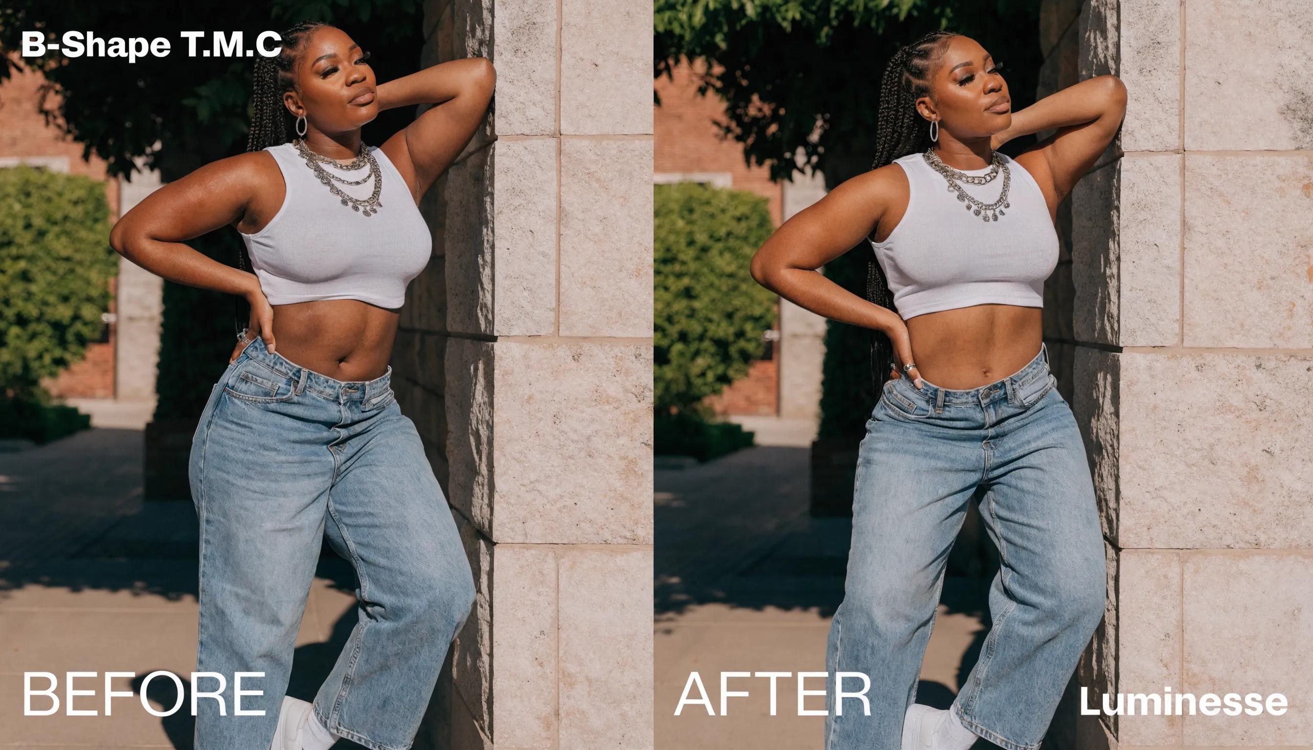 Before and after results of B-Shape T.M.C muscle sculpting, highlighting enhanced muscle tone and fat reduction